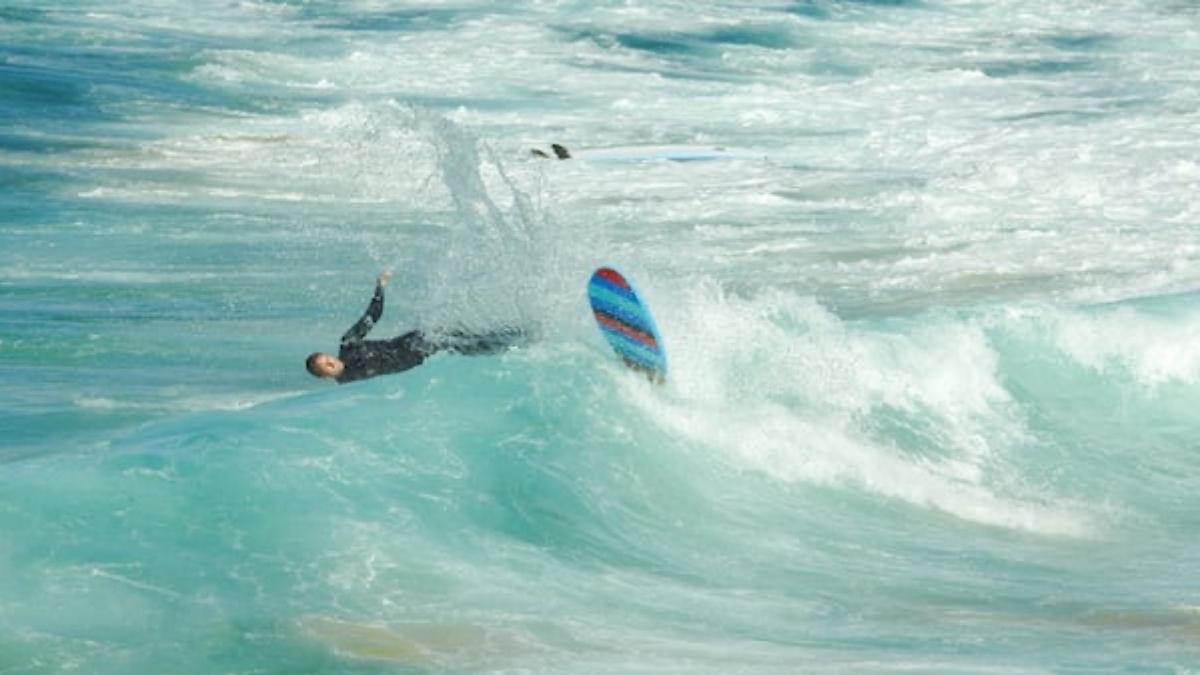 Il perd sa jambe dans une attaque de requin mais réussit l&rsquo;impossible pour survivre : son histoire va vous glacer le sang